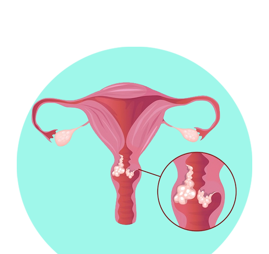 Gynae Laparoscopic Surgeon