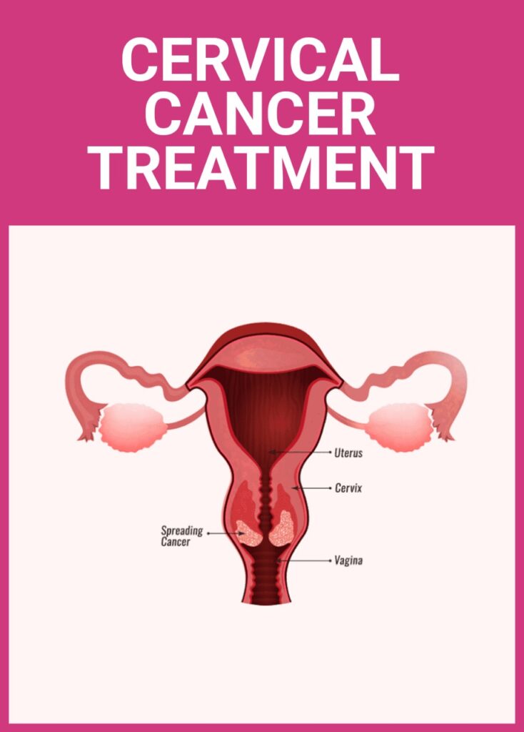 Cervix cancer specialist in Mumbai