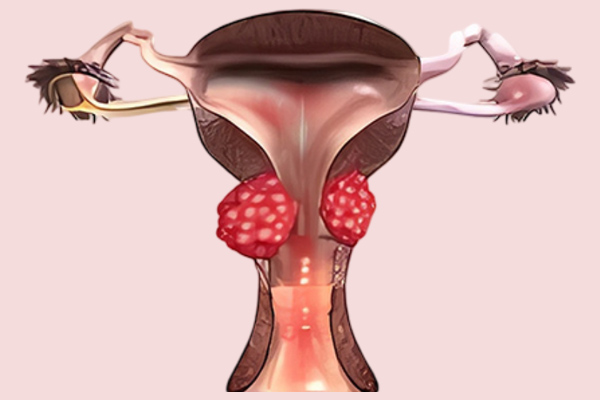 Best Gynae Onco in Mumbai
